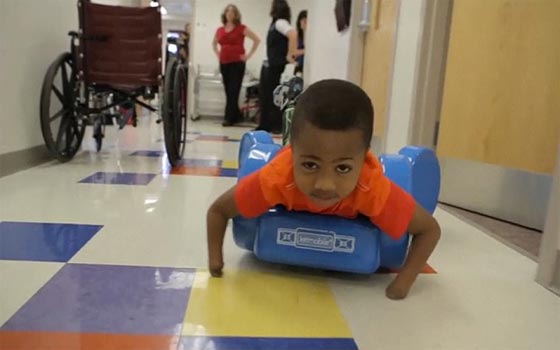 اول مرة في العالم.. عملية زرع يدين لطفل امريكي تتكلل بالنجاح صورة رقم 2 اول مرة في العالم.. عملية زرع يدين لطفل امريكي تتكلل بالنجاح صورة رقم 2