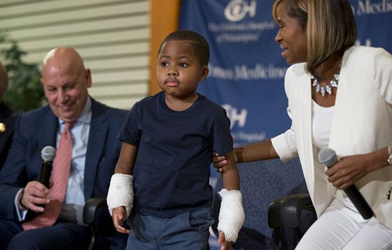 اول مرة في العالم.. عملية زرع يدين لطفل امريكي تتكلل بالنجاح صورة رقم 11 اول مرة في العالم.. عملية زرع يدين لطفل امريكي تتكلل بالنجاح صورة رقم 11