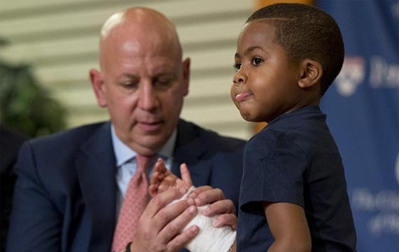 اول مرة في العالم.. عملية زرع يدين لطفل امريكي تتكلل بالنجاح صورة رقم 13 اول مرة في العالم.. عملية زرع يدين لطفل امريكي تتكلل بالنجاح صورة رقم 13