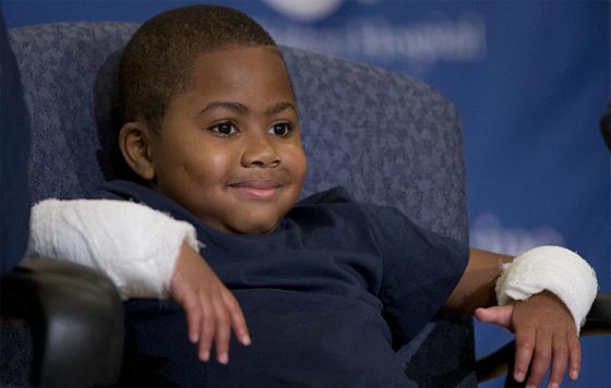 اول مرة في العالم.. عملية زرع يدين لطفل امريكي تتكلل بالنجاح صورة رقم 12 اول مرة في العالم.. عملية زرع يدين لطفل امريكي تتكلل بالنجاح صورة رقم 12