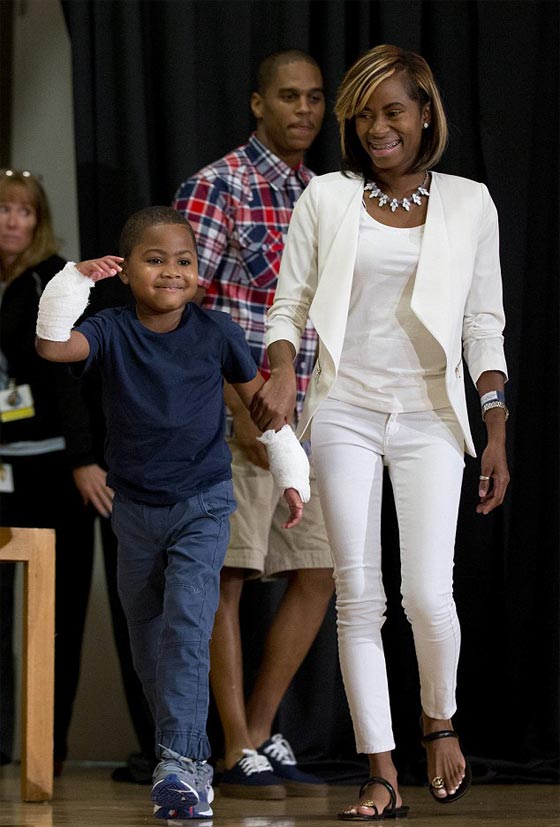 اول مرة في العالم.. عملية زرع يدين لطفل امريكي تتكلل بالنجاح صورة رقم 14 اول مرة في العالم.. عملية زرع يدين لطفل امريكي تتكلل بالنجاح صورة رقم 14