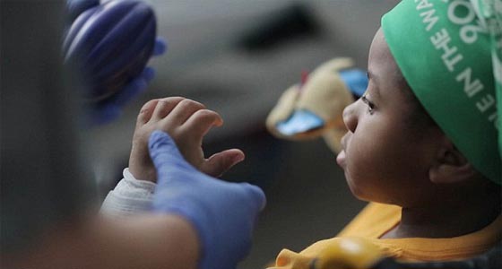 اول مرة في العالم.. عملية زرع يدين لطفل امريكي تتكلل بالنجاح صورة رقم 8 اول مرة في العالم.. عملية زرع يدين لطفل امريكي تتكلل بالنجاح صورة رقم 8