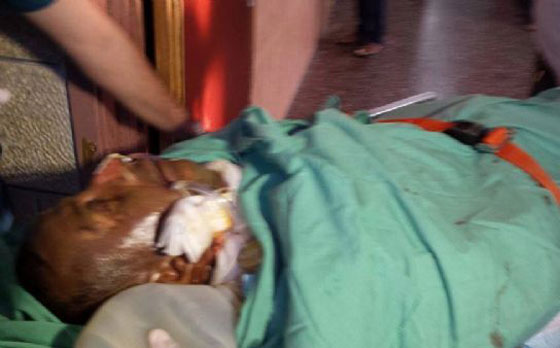 سماء فلسطين ترتعش..سعد دوابشة يلحق بابنه على الى الملأ الاعلى.. متاثرا باصاباته صورة رقم 1 سماء فلسطين ترتعش..سعد دوابشة يلحق بابنه على الى الملأ الاعلى.. متاثرا باصاباته صورة رقم 1