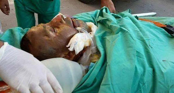 سماء فلسطين ترتعش..سعد دوابشة يلحق بابنه على الى الملأ الاعلى.. متاثرا باصاباته صورة رقم 2 سماء فلسطين ترتعش..سعد دوابشة يلحق بابنه على الى الملأ الاعلى.. متاثرا باصاباته صورة رقم 2