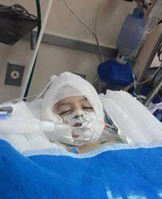 سماء فلسطين ترتعش..سعد دوابشة يلحق بابنه على الى الملأ الاعلى.. متاثرا باصاباته صورة رقم 7 سماء فلسطين ترتعش..سعد دوابشة يلحق بابنه على الى الملأ الاعلى.. متاثرا باصاباته صورة رقم 7