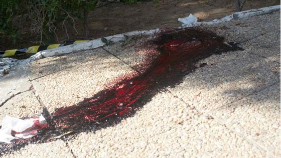 الدواعش يشنون هجوما مزيفا على منتجع تركي.. شاهدهم بالصور صورة رقم 10