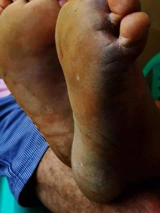 تعذيب السلطة لاحد مواطنيها قد يكلفها مليون دولار عدا ونقدا!! صورة رقم 4