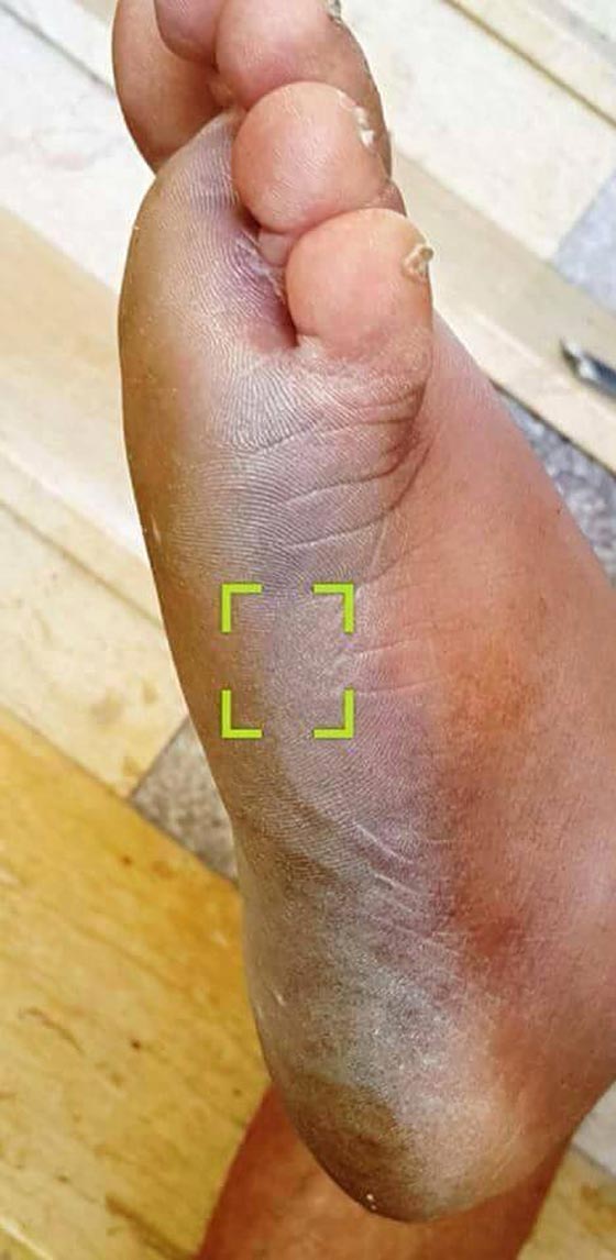 تعذيب السلطة لاحد مواطنيها قد يكلفها مليون دولار عدا ونقدا!! صورة رقم 5