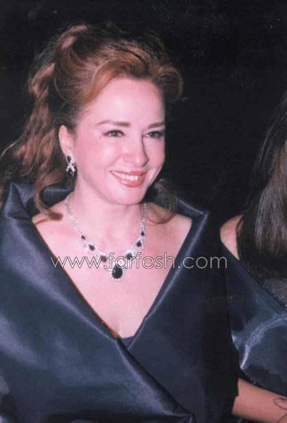 الفنانة نجلاء فتحي في حالة صحية سيئة والتهاب في الكبد أثناء علاجها من الصدفية صورة رقم 4
