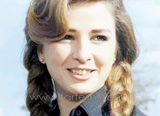 الفنانة نجلاء فتحي في حالة صحية سيئة والتهاب في الكبد أثناء علاجها من الصدفية صورة رقم 8