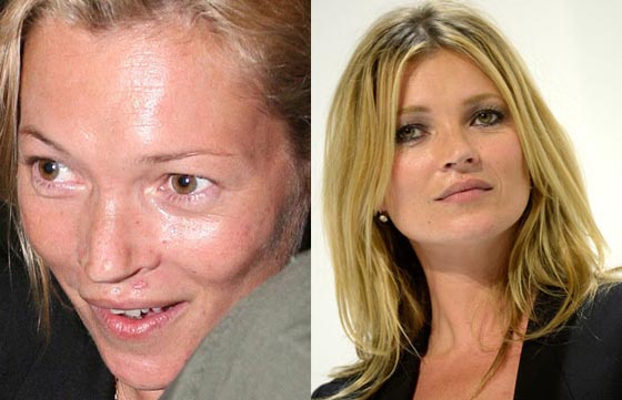صور فنانات عالميات بدون مكياج: لن تصدّق الفرق!   صورة رقم 11