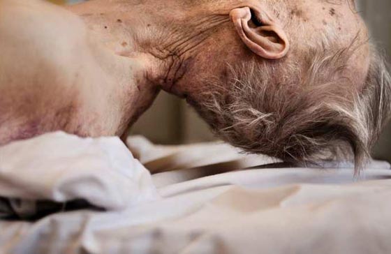 كاميرا في المشرحة.. مصورة توثق ما يحدث لجسد الانسان بعد موته صورة رقم 7