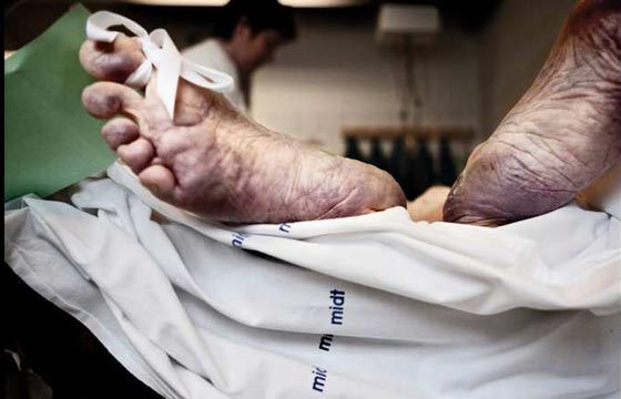 كاميرا في المشرحة.. مصورة توثق ما يحدث لجسد الانسان بعد موته صورة رقم 9