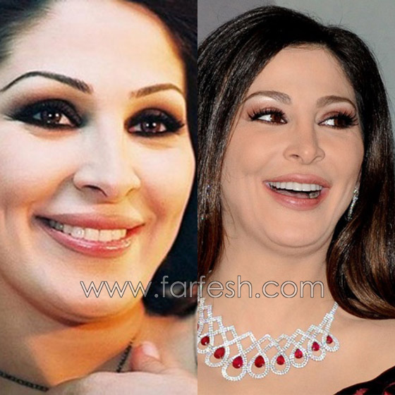 بالصور.. شاهد كم يغير تجميل الحواجب والشفاه في اطلالة الفنانات صورة رقم 4