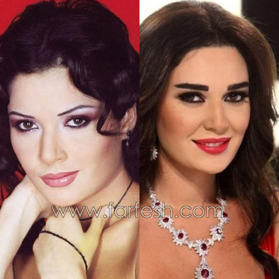 بالصور.. شاهد كم يغير تجميل الحواجب والشفاه في اطلالة الفنانات صورة رقم 2