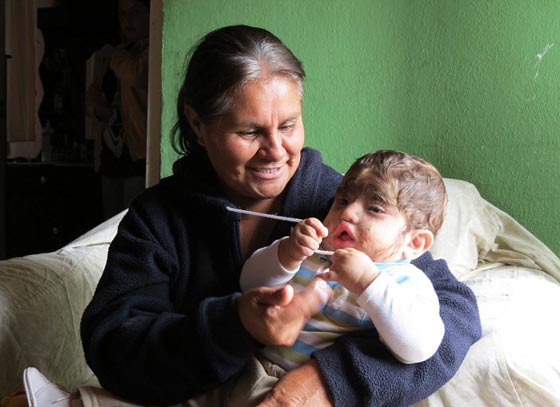 بالصور.. عائلة الذئاب في المكسيك 31 فردا يغطيهم الشعر الكثيف صورة رقم 3