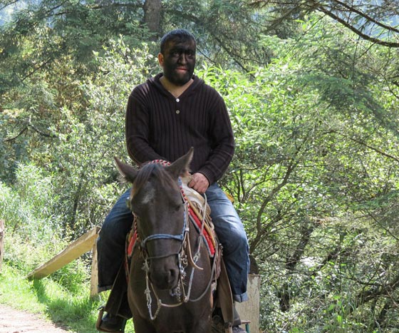 بالصور.. عائلة الذئاب في المكسيك 31 فردا يغطيهم الشعر الكثيف صورة رقم 9