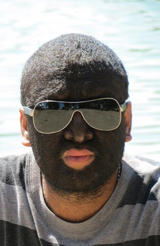 بالصور.. عائلة الذئاب في المكسيك 31 فردا يغطيهم الشعر الكثيف صورة رقم 18