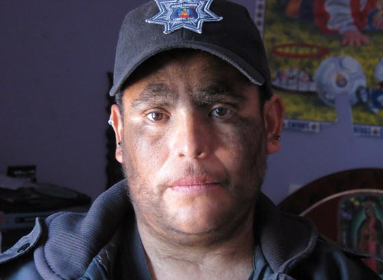 بالصور.. عائلة الذئاب في المكسيك 31 فردا يغطيهم الشعر الكثيف صورة رقم 19