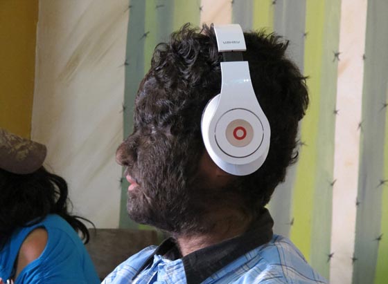 بالصور.. عائلة الذئاب في المكسيك 31 فردا يغطيهم الشعر الكثيف صورة رقم 20