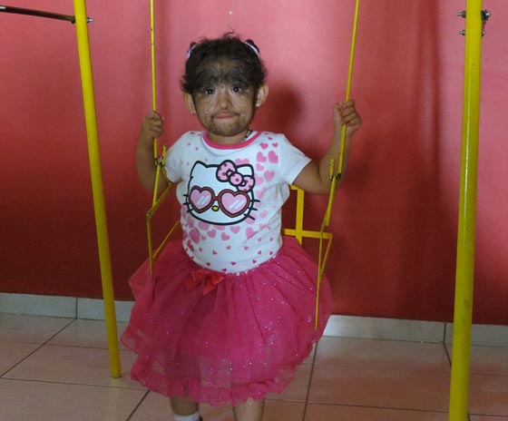 بالصور.. عائلة الذئاب في المكسيك 31 فردا يغطيهم الشعر الكثيف صورة رقم 21