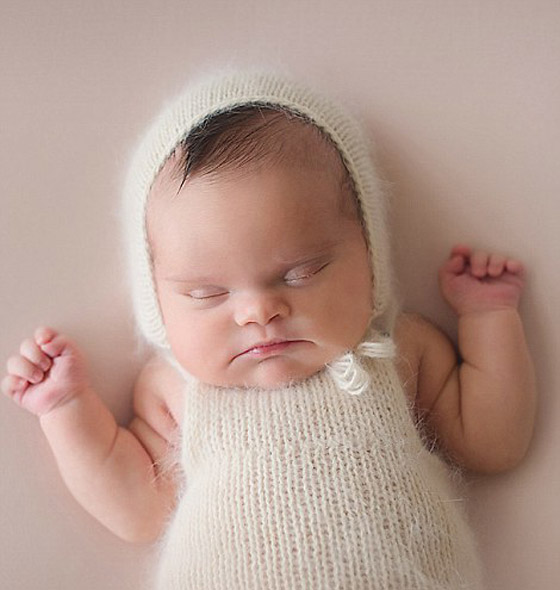 صور مؤثرة جدا: عائلة تودّع طفلتها المصابة بالسرطان بـ جلسة تصوير لتخليد حياتها القصيرة صورة رقم 8