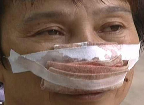 متوحش يقضم انف زوجته ويبتلعه ايضا!! صورة رقم 1