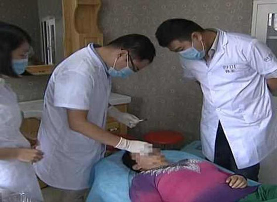 متوحش يقضم انف زوجته ويبتلعه ايضا!! صورة رقم 2