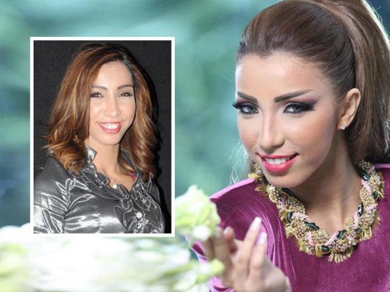 صور دينا بطمة توضّح ما فعلته بها عمليات التجميل   صورة رقم 1