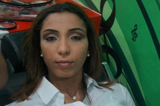 صور دينا بطمة توضّح ما فعلته بها عمليات التجميل   صورة رقم 3
