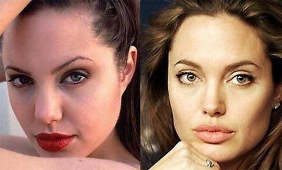 صور انوف نجمات هوليوود قبل عمليات التجميل وبعدها صورة رقم 23