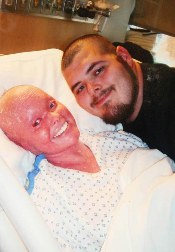 فيديو وصور: امرأة مصابة بمرض جلدي نادر تصبح اما وتدهش الأطباء صورة رقم 4