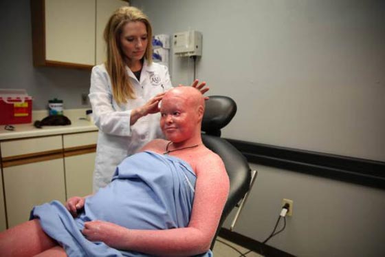 فيديو وصور: امرأة مصابة بمرض جلدي نادر تصبح اما وتدهش الأطباء صورة رقم 7