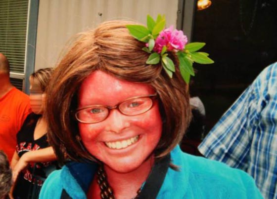 فيديو وصور: امرأة مصابة بمرض جلدي نادر تصبح اما وتدهش الأطباء صورة رقم 11