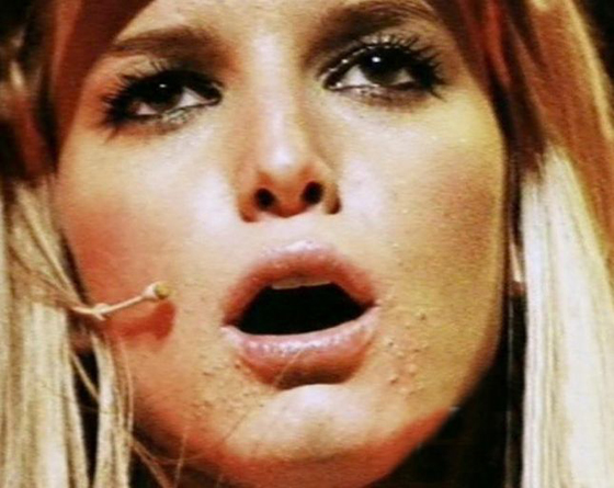 صور فنانات عالميات يعانين هن ايضا من (حب الشباب) صورة رقم 6