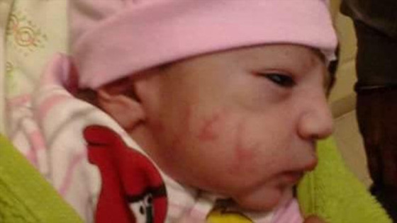 لماذا روّج انصار الاسد لرضيع واعتبروه معجزة ايرانية؟ صورة رقم 1 لماذا روّج انصار الاسد لرضيع واعتبروه معجزة ايرانية؟ صورة رقم 1