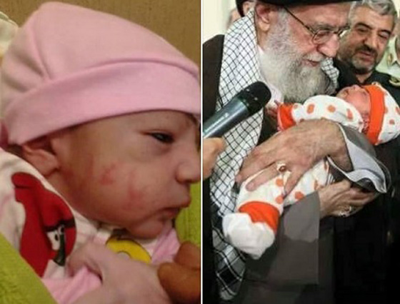 لماذا روّج انصار الاسد لرضيع واعتبروه معجزة ايرانية؟ صورة رقم 2 لماذا روّج انصار الاسد لرضيع واعتبروه معجزة ايرانية؟ صورة رقم 2