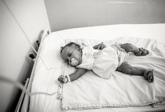 مصور يتتبع حالة طفلتين ملتصقتين حتى انفصالهما جسديا صورة رقم 11