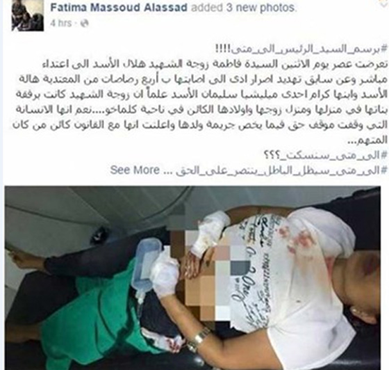 اصابة زوجة هلال الاسد باربع رصاصات من سلاح هالة الاسد صورة رقم 1 اصابة زوجة هلال الاسد باربع رصاصات من سلاح هالة الاسد صورة رقم 1