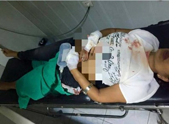 اصابة زوجة هلال الاسد باربع رصاصات من سلاح هالة الاسد صورة رقم 3 اصابة زوجة هلال الاسد باربع رصاصات من سلاح هالة الاسد صورة رقم 3