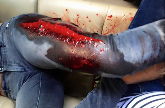 اصابة زوجة هلال الاسد باربع رصاصات من سلاح هالة الاسد صورة رقم 4 اصابة زوجة هلال الاسد باربع رصاصات من سلاح هالة الاسد صورة رقم 4