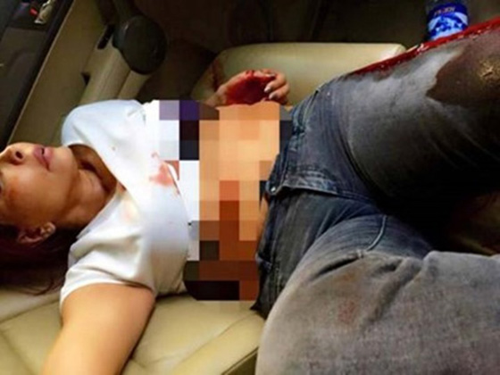 اصابة زوجة هلال الاسد باربع رصاصات من سلاح هالة الاسد صورة رقم 2 اصابة زوجة هلال الاسد باربع رصاصات من سلاح هالة الاسد صورة رقم 2