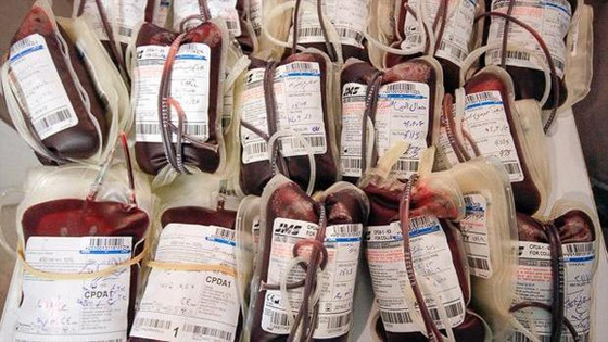 بعد استيرادها للابر والحجارة.. ايران تستورد الدم الصيني بكميات جبارة صورة رقم 2 بعد استيرادها للابر والحجارة.. ايران تستورد الدم الصيني بكميات جبارة صورة رقم 2