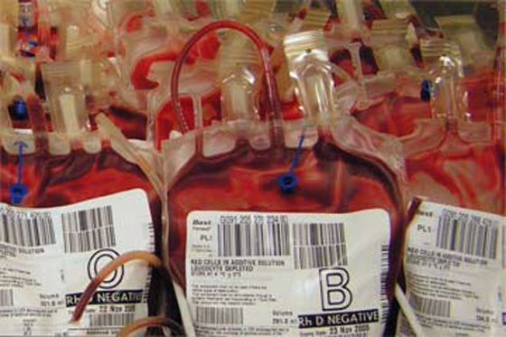 بعد استيرادها للابر والحجارة.. ايران تستورد الدم الصيني بكميات جبارة صورة رقم 3 بعد استيرادها للابر والحجارة.. ايران تستورد الدم الصيني بكميات جبارة صورة رقم 3