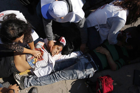 قتلى وجرحى في انفجار وسط مظاهرة للسلام في انقرة التركية صورة رقم 7