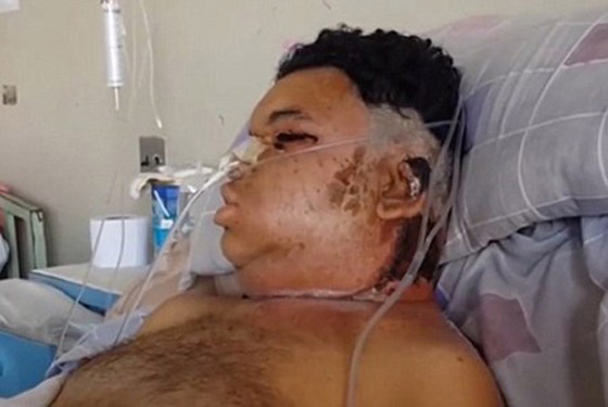  شاهد ماذا فعلت لدغة عقرب سام بهذا الرجل صورة رقم 1