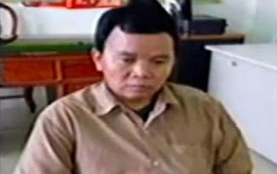 طبيب متهم بالقتل لانه نقل فيروس الايدز لـ 100 متعالج لديه صورة رقم 4 طبيب متهم بالقتل لانه نقل فيروس الايدز لـ 100 متعالج لديه صورة رقم 4