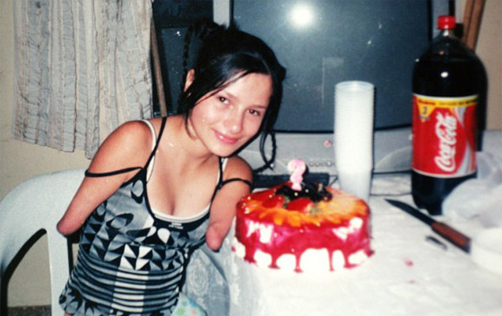 صور وفيديو فنانة مبدعة بدون ذراعين ولا ساقين اذهلت العالم صورة رقم 16