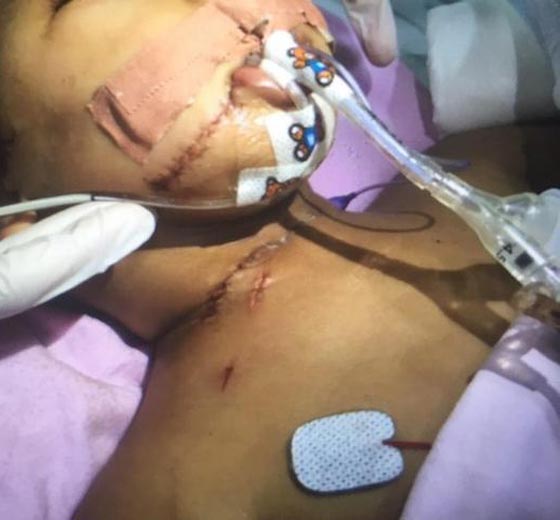  صور صادمة.. خادمة تذبح رضيعا وامه تنقذه في اللحظة الاخيرة  صورة رقم 1