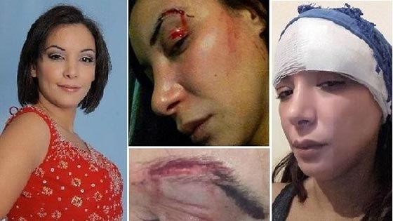 الاعتداء على مغربية مثلت دور مومس.. حادث يخلو من التفاصيل! صورة رقم 1 الاعتداء على مغربية مثلت دور مومس.. حادث يخلو من التفاصيل! صورة رقم 1